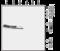 Solute Carrier Family 17 Member 6 antibody, GTX54871, GeneTex, Western Blot image 