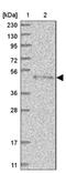 Splicing Factor 3b Subunit 4 antibody, NBP1-83191, Novus Biologicals, Western Blot image 