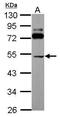 Solute Carrier Family 25 Member 23 antibody, PA5-30702, Invitrogen Antibodies, Western Blot image 