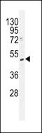 TRNA Methyltransferase 2 Homolog B antibody, LS-C160224, Lifespan Biosciences, Western Blot image 