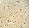 O-Linked N-Acetylglucosamine (GlcNAc) Transferase antibody, LS-C163114, Lifespan Biosciences, Immunohistochemistry paraffin image 