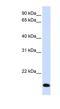 Ring Finger Protein 185 antibody, NBP1-59761, Novus Biologicals, Western Blot image 