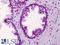 Aryl Hydrocarbon Receptor antibody, LS-B4900, Lifespan Biosciences, Immunohistochemistry paraffin image 