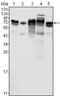 Metadherin antibody, GTX83259, GeneTex, Western Blot image 