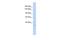 WW Domain Containing E3 Ubiquitin Protein Ligase 1 antibody, A03716, Boster Biological Technology, Western Blot image 