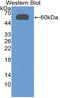 Alpha-aminoadipic semialdehyde dehydrogenase antibody, LS-C314308, Lifespan Biosciences, Western Blot image 