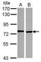 Sodium Channel Epithelial 1 Delta Subunit antibody, PA5-30864, Invitrogen Antibodies, Western Blot image 