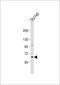 Polypeptide N-Acetylgalactosaminyltransferase 9 antibody, 59-559, ProSci, Western Blot image 