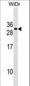 Fas Associated Via Death Domain antibody, LS-C157738, Lifespan Biosciences, Western Blot image 