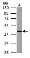 Fumarate Hydratase antibody, GTX110128, GeneTex, Western Blot image 