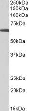 Ribosomal Protein S6 Kinase B1 antibody, STJ70247, St John