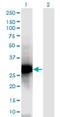 Nucleophosmin/Nucleoplasmin 2 antibody, H00010361-M03, Novus Biologicals, Western Blot image 