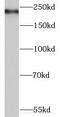 Myosin XVI antibody, FNab05500, FineTest, Western Blot image 