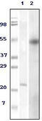 FOXP3 antibody, STJ98088, St John