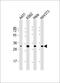 Cyclin Dependent Kinase 5 antibody, M00511-2, Boster Biological Technology, Western Blot image 