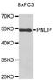 Pancreatic Lipase antibody, orb373629, Biorbyt, Western Blot image 