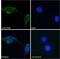 NADH:Ubiquinone Oxidoreductase Core Subunit S1 antibody, 42-624, ProSci, Western Blot image 