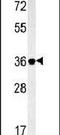 Galectin 9B antibody, PA5-23573, Invitrogen Antibodies, Western Blot image 