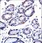 G3BP Stress Granule Assembly Factor 1 antibody, LS-C166301, Lifespan Biosciences, Immunohistochemistry paraffin image 