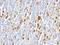 TNF Receptor Superfamily Member 8 antibody, NBP2-48245, Novus Biologicals, Immunohistochemistry paraffin image 