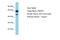 Peptidase M20 Domain Containing 1 antibody, A12394, Boster Biological Technology, Western Blot image 