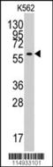 Tyrosyl-TRNA Synthetase 2 antibody, 63-229, ProSci, Western Blot image 