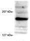 Nuclear Receptor Coactivator 3 antibody, GTX22782, GeneTex, Western Blot image 
