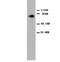 Protein Kinase C Alpha antibody, orb18062, Biorbyt, Western Blot image 