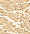 Receptor Tyrosine Kinase Like Orphan Receptor 1 antibody, 63-129, ProSci, Immunohistochemistry frozen image 