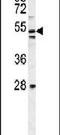 MTOR Associated Protein, Eak-7 Homolog antibody, PA5-24016, Invitrogen Antibodies, Western Blot image 