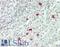 Pyrimidinergic Receptor P2Y4 antibody, LS-B14493, Lifespan Biosciences, Immunohistochemistry paraffin image 