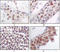 MAPK Activated Protein Kinase 5 antibody, M07923, Boster Biological Technology, Immunohistochemistry frozen image 