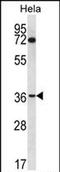 Nucleoporin 35 antibody, PA5-71760, Invitrogen Antibodies, Western Blot image 