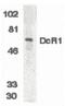 TNF Receptor Superfamily Member 10c antibody, PA5-19932, Invitrogen Antibodies, Western Blot image 