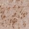 Diphosphoinositol Pentakisphosphate Kinase 2 antibody, PA5-58154, Invitrogen Antibodies, Immunohistochemistry frozen image 