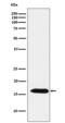 Peroxiredoxin 5 antibody, M02891-1, Boster Biological Technology, Western Blot image 