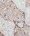 GTP Binding Protein 3, Mitochondrial antibody, FNab03721, FineTest, Immunohistochemistry paraffin image 
