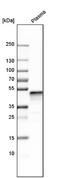 Serpin Family F Member 1 antibody, NBP1-83972, Novus Biologicals, Western Blot image 