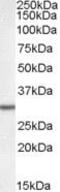 Dolichyl-Phosphate Mannosyltransferase Subunit 1, Catalytic antibody, PA5-19028, Invitrogen Antibodies, Western Blot image 