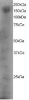 Dedicator Of Cytokinesis 1 antibody, PA5-17969, Invitrogen Antibodies, Western Blot image 