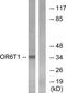 Olfactory Receptor Family 6 Subfamily T Member 1 antibody, TA316238, Origene, Western Blot image 