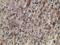 Zinc Finger Imprinted 2 antibody, GTX83403, GeneTex, Immunohistochemistry paraffin image 