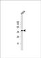 Actin Related Protein 2/3 Complex Subunit 1B antibody, PA5-72568, Invitrogen Antibodies, Western Blot image 