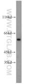 SRC Proto-Oncogene, Non-Receptor Tyrosine Kinase antibody, 11097-1-AP, Proteintech Group, Western Blot image 