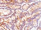Carcinoembryonic Antigen Related Cell Adhesion Molecule 5 antibody, AM10076PU-S, Origene, Immunohistochemistry paraffin image 