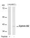 Ephrin B2 antibody, 79-575, ProSci, Western Blot image 