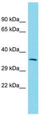 Immunoglobulin-binding protein 1b antibody, TA343172, Origene, Western Blot image 