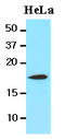 Cofilin 1 antibody, LS-B2971, Lifespan Biosciences, Western Blot image 