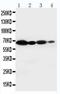 Cytochrome B-245 Beta Chain antibody, PA5-79118, Invitrogen Antibodies, Western Blot image 