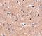 Polypeptide N-Acetylgalactosaminyltransferase 10 antibody, NBP1-77059, Novus Biologicals, Immunohistochemistry paraffin image 